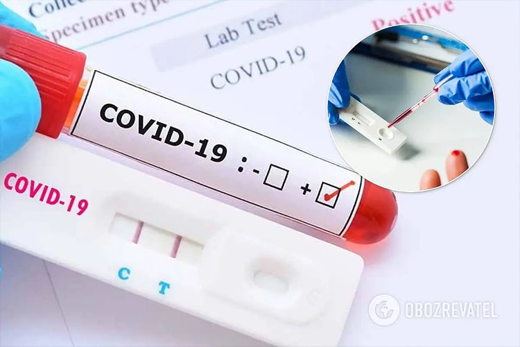 ТЕСТЫ НА COVID-19 ПРИ ВЪЕЗДЕ ВО ФРАНЦИЮ СТАНУТ ПЛАТНЫМИ
